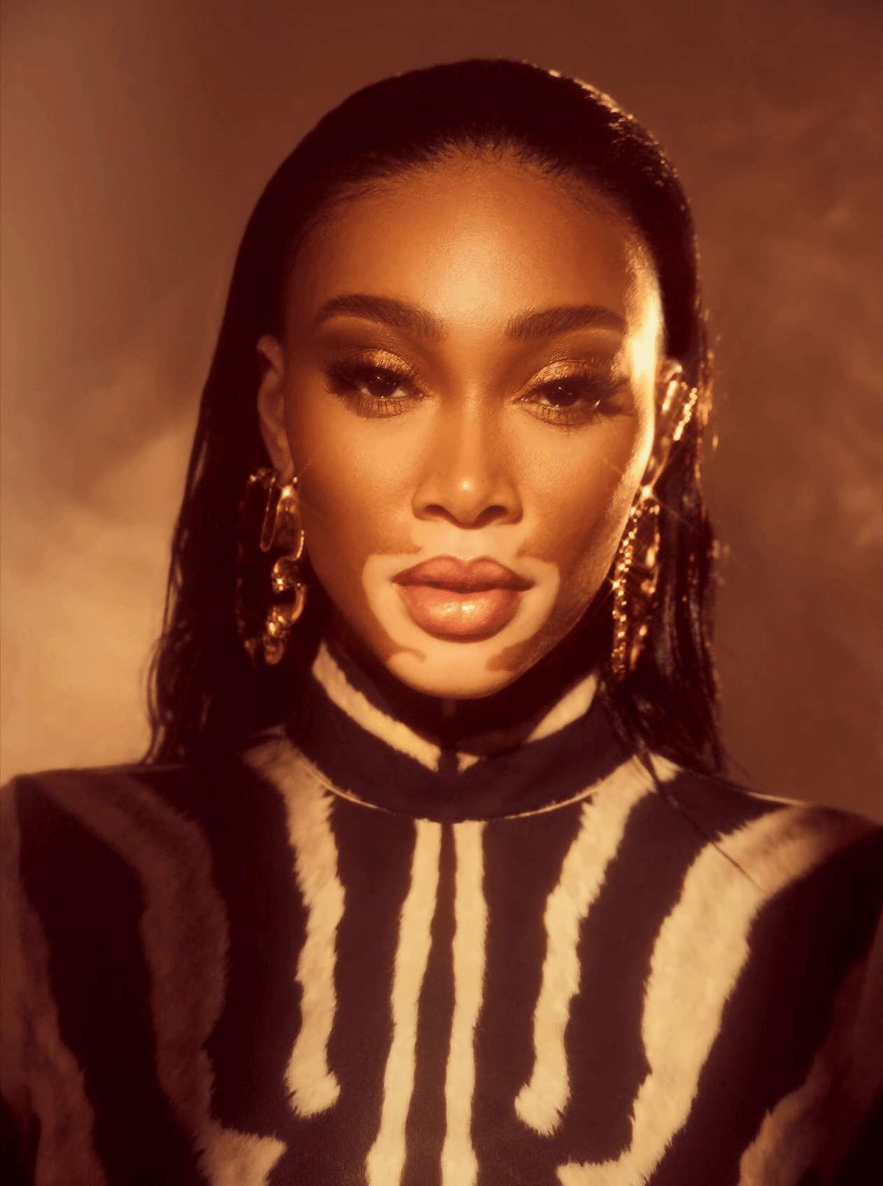 winnie-harlow-526163_23d10ae0-b0bd-4a48-a179-5d1e46f3575a.png